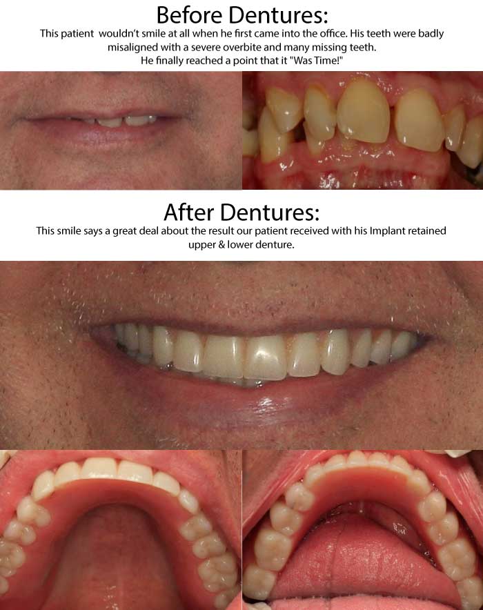 Best Duncan OK Denture Dentist