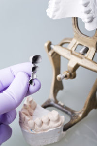 hand of dentist holding dental gypsum models