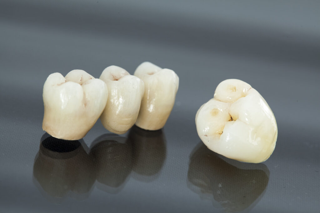 Dental Crowns and Bridges Duncan